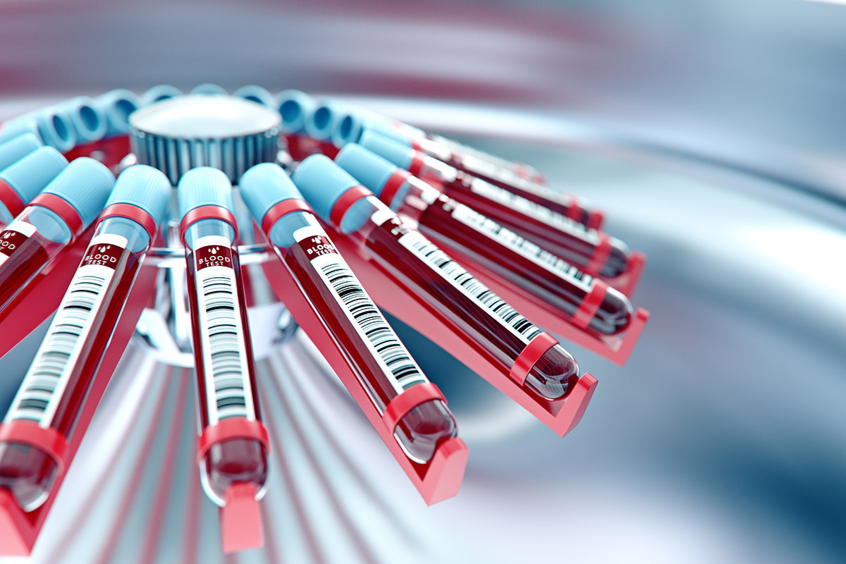 Medizin- Labortechnik Möbius in Pirna - Leistungen - Analyselabore